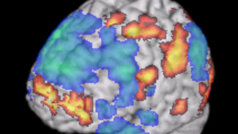 Imagen de resonancia magnética funcional del cerebro
