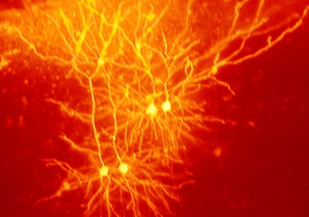 La ketamina y la MDMA reescriben la actividad de los genes del cerebro, según un nuevo estudio