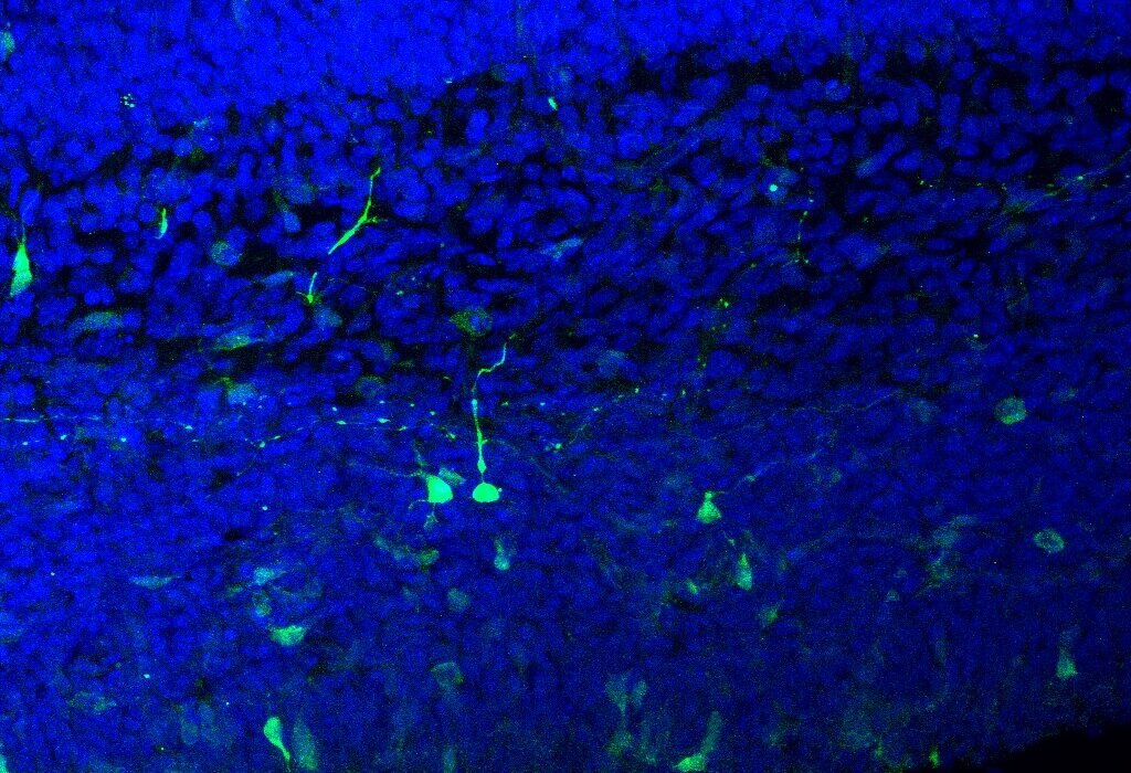 Una sola dosis de psilocibina reduce la búsqueda de recompensas en el cerebro