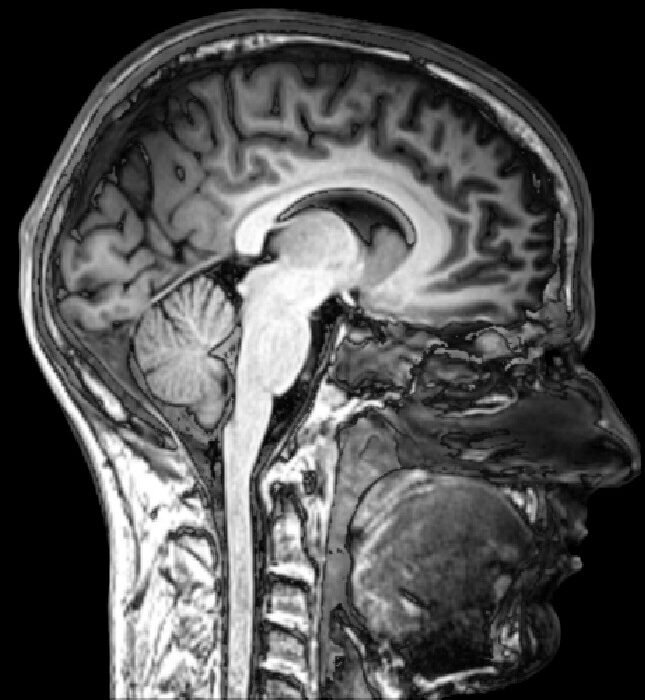 ¿Puede la psilocibina proteger el cerebro tras golpes leves en la cabeza? Un estudio en ratas abre la puerta